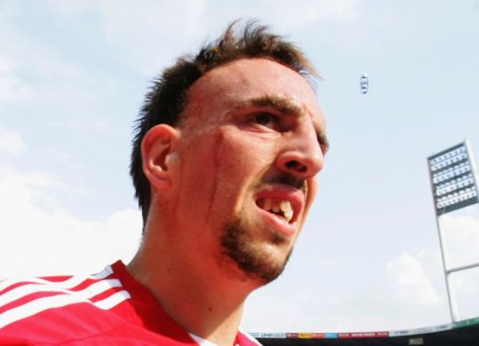 Ribéry hatvan percet már bír
