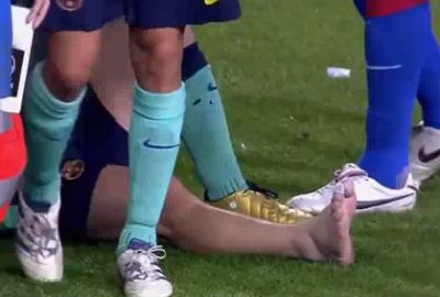 Messi bokája azonnal felduzzadt